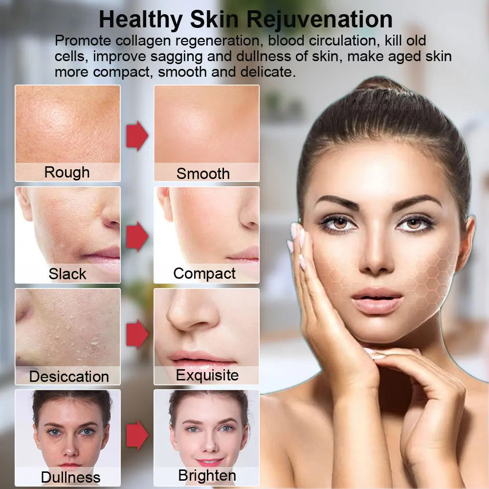 Hifu Face Lifting Machine RF High Frequency Anti-aging