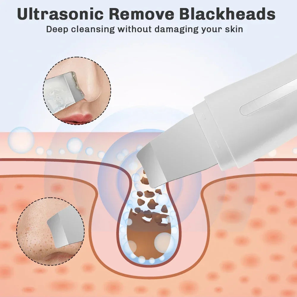 Ultrasonic Face Skin Scrubber Skin Spatula Facial