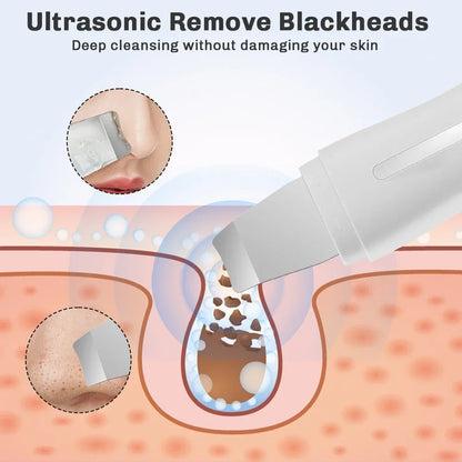 Ultrasonic Face Skin Scrubber Skin Spatula Facial
